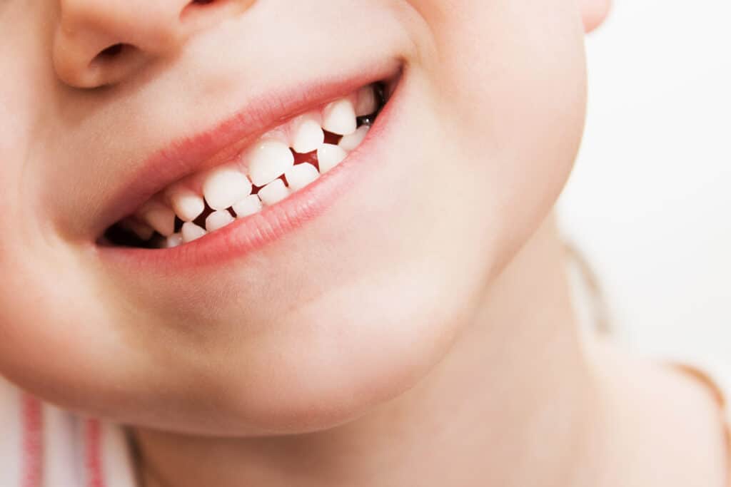 baby smile close. child teeth on a white isolated background.