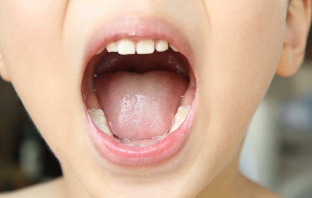 close up child open mouth.