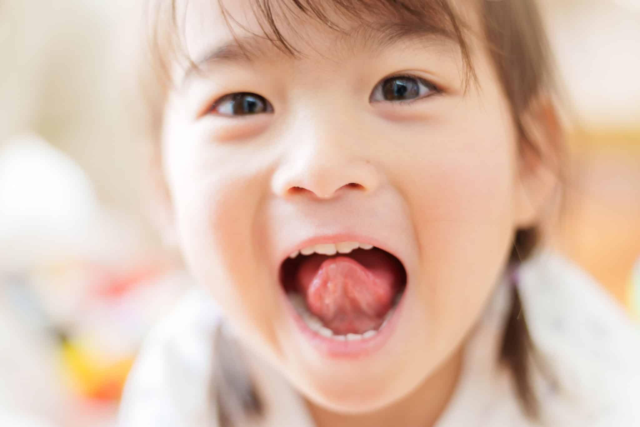 子どもの低位舌|舌の正しい位置と治し方 | ABC Dental