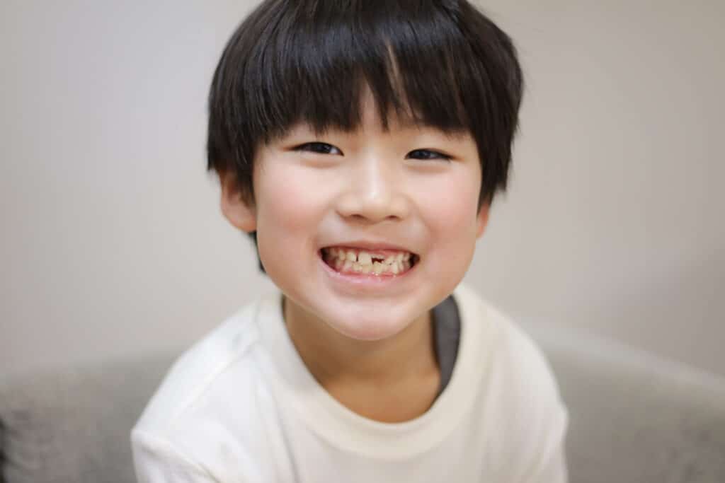 前歯の抜けた男の子