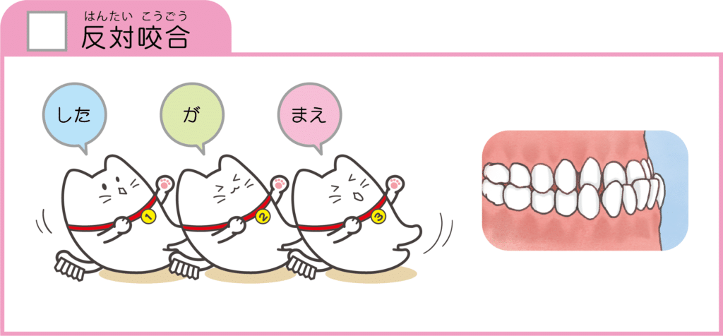 不正咬合08