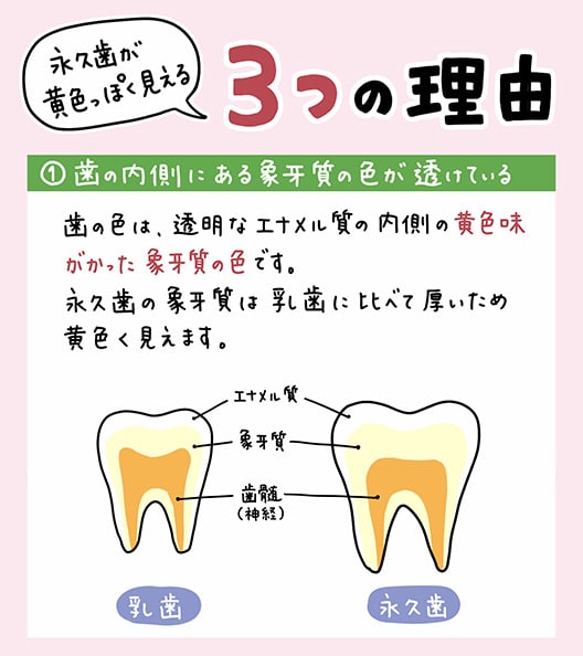 子どもの生えてきた永久歯が_2_子どもの永久歯と乳歯の比較、黄色に見える理由を解説するイラスト、適切な対策を示す図と解説