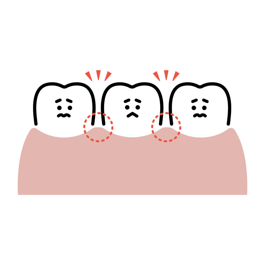 すきっ歯(キャラクター)