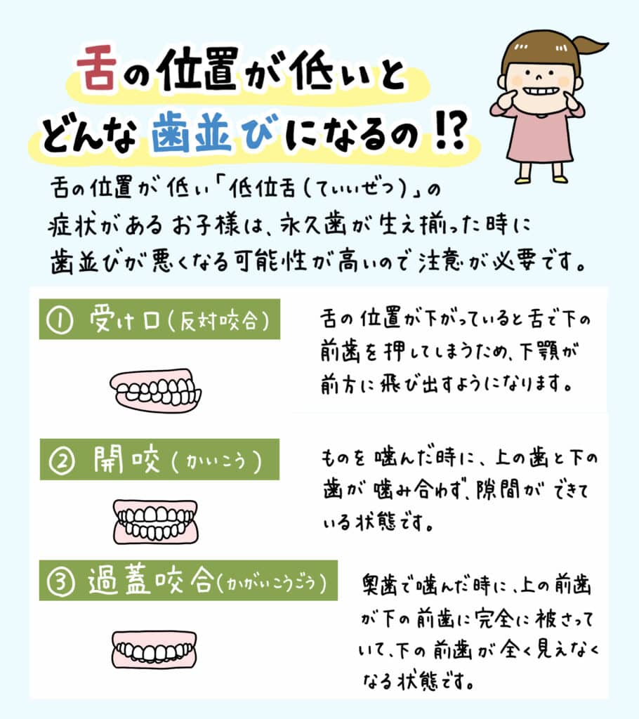 舌の位置が低い子供は_5_舌の低い位置が口腔健康に及ぼす影響について学ぶ子供のイラスト解説