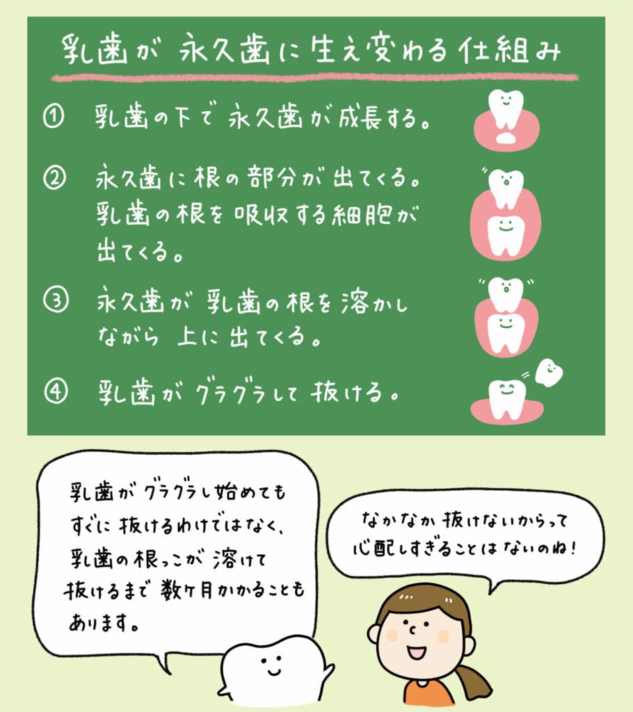 乳歯がぐらぐらしてきた_4_子供の乳歯が抜けない場合の対処法を示す教育的なイラスト