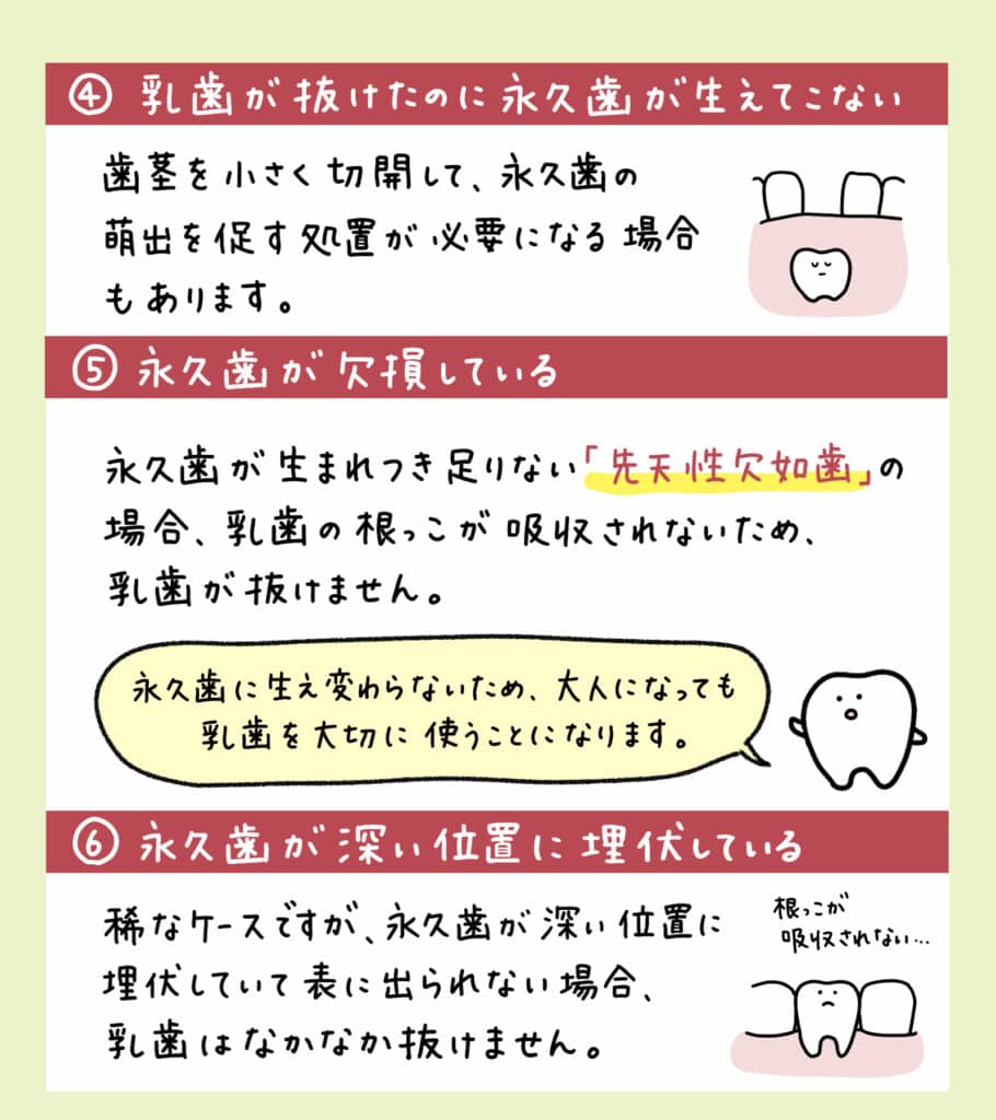 乳歯がぐらぐらしてきた_10_子供の乳歯が抜けない場合の対処法を示す教育的なイラスト
