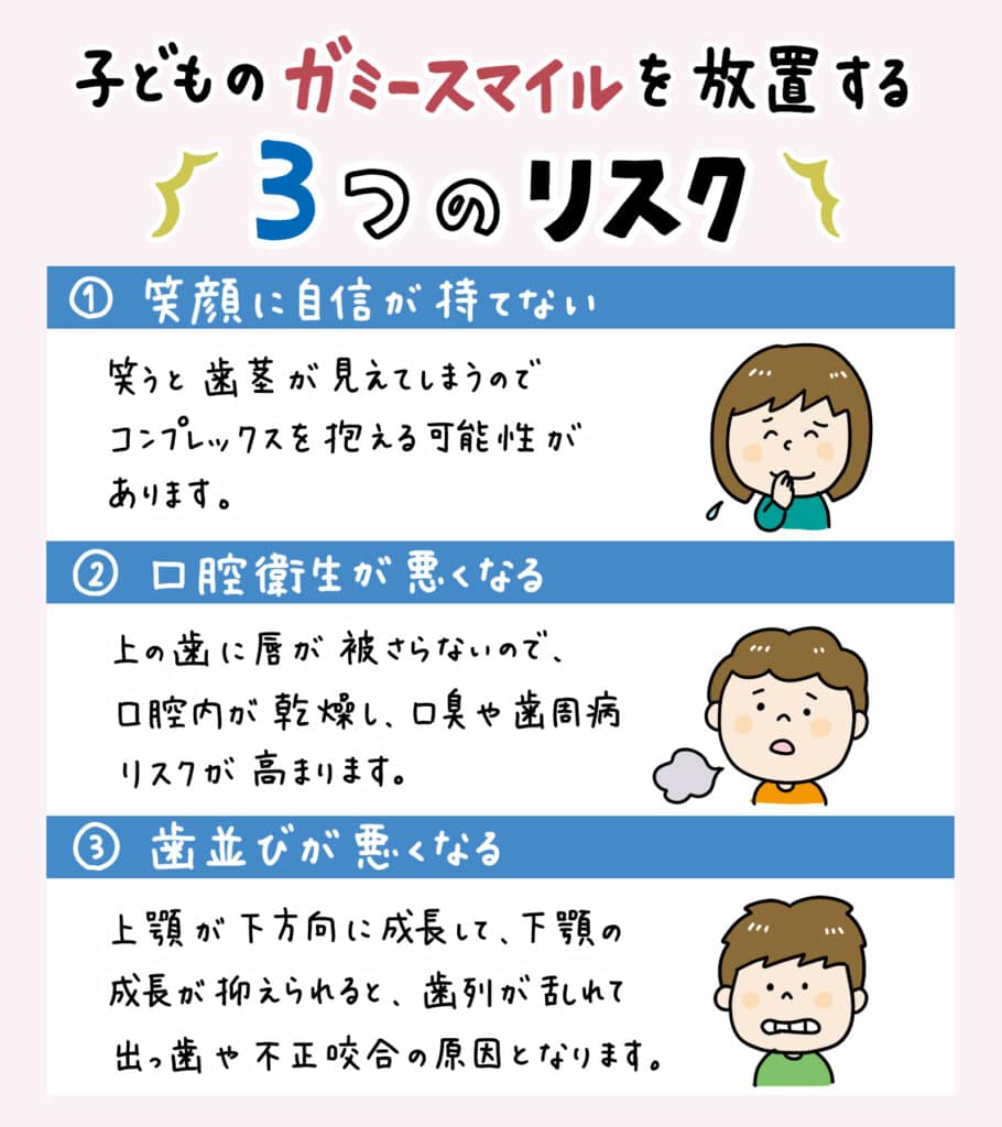 笑うと歯茎が見える_4_ガミースマイルとは何か、およびその原因と治療法を説明するイラスト解説