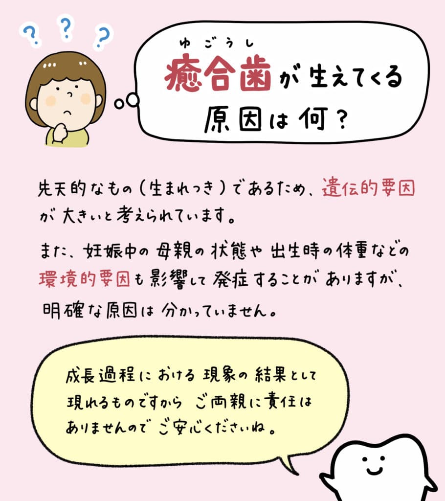 歯科検診で癒合歯と診断されたら?_5_子供の歯の癒合歯について解説するイラスト