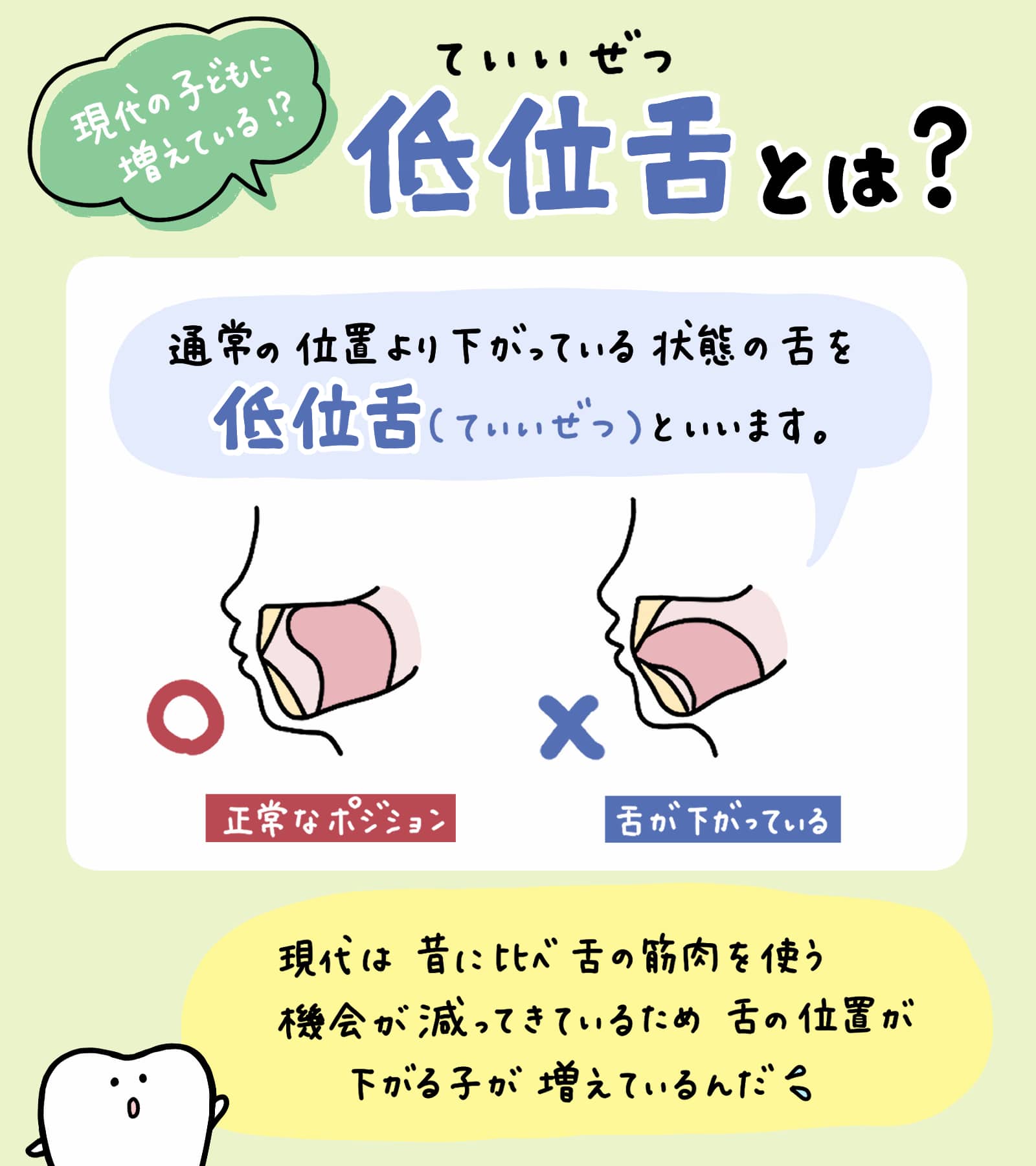 子どもの舌トレーニング(MFT)やり方ガイド|正しい舌の位置