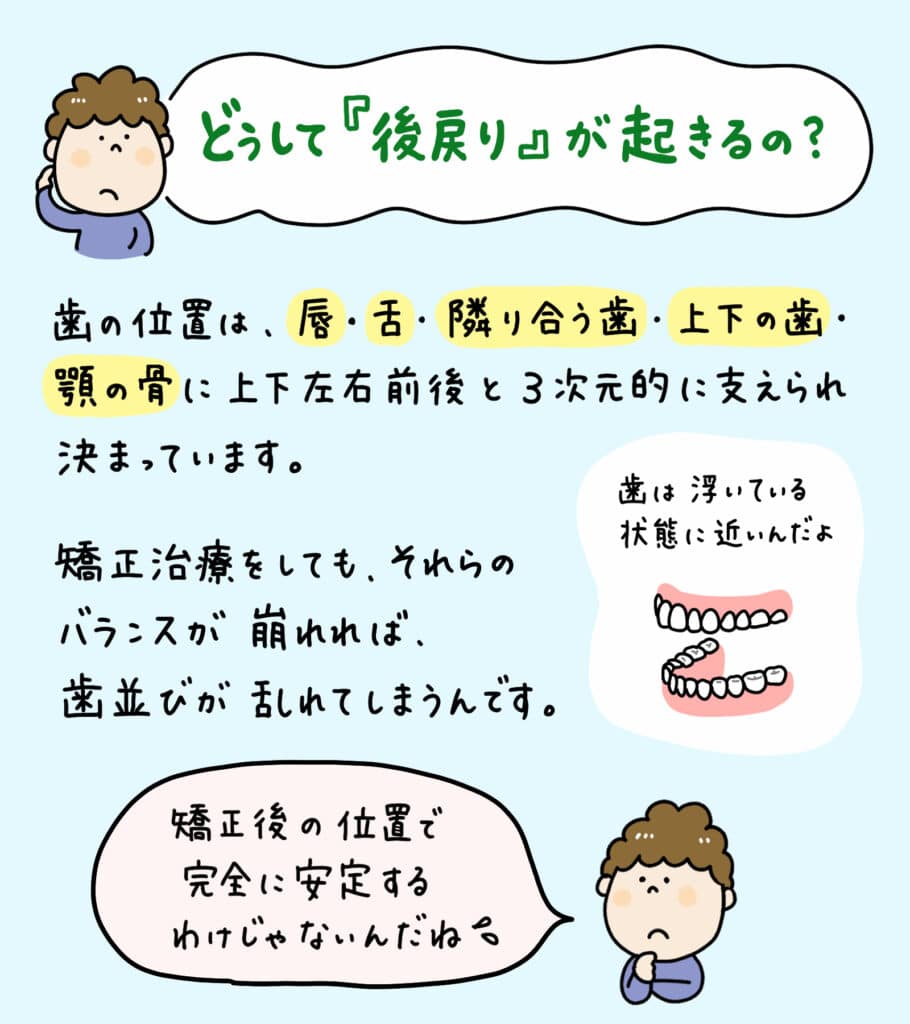 後戻り_矯正治療の落とし穴_2_矯正治療の後戻りを防ぐための重要ポイントを解説するイラスト