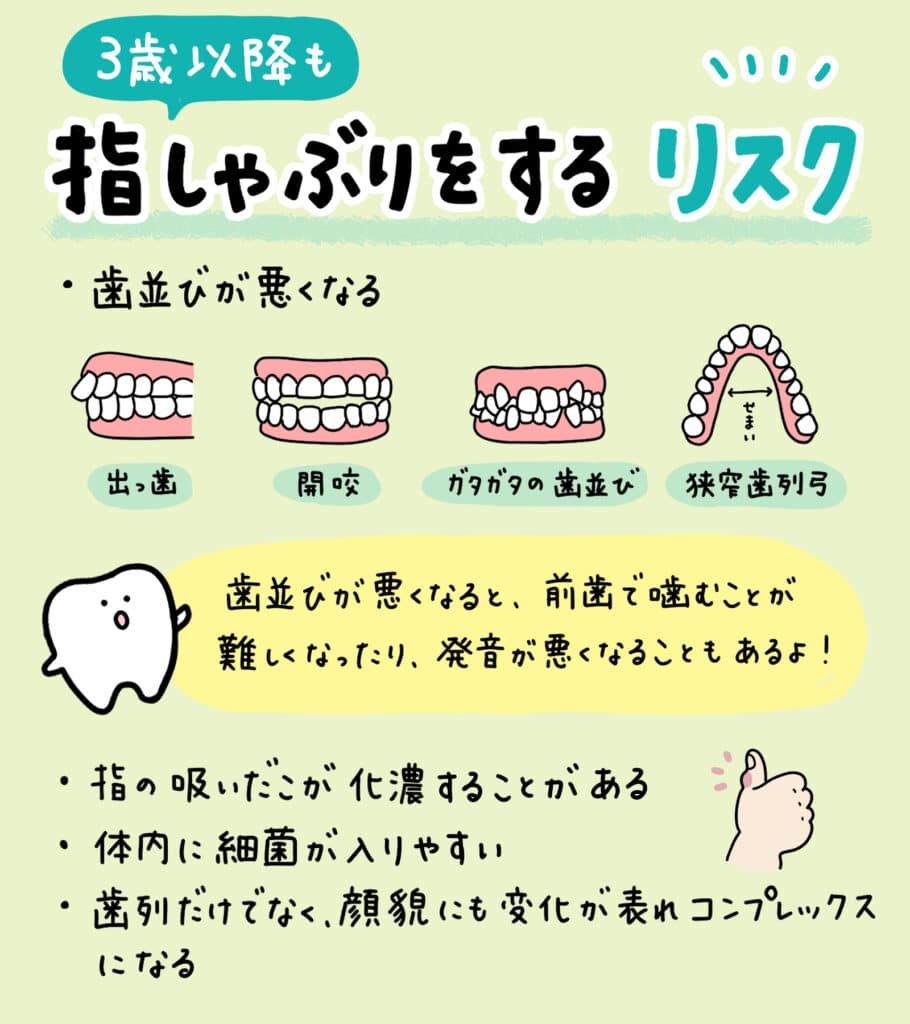 指しゃぶりの原因_4_指しゃぶり(指吸い)の原因と対処法を解説するイラスト