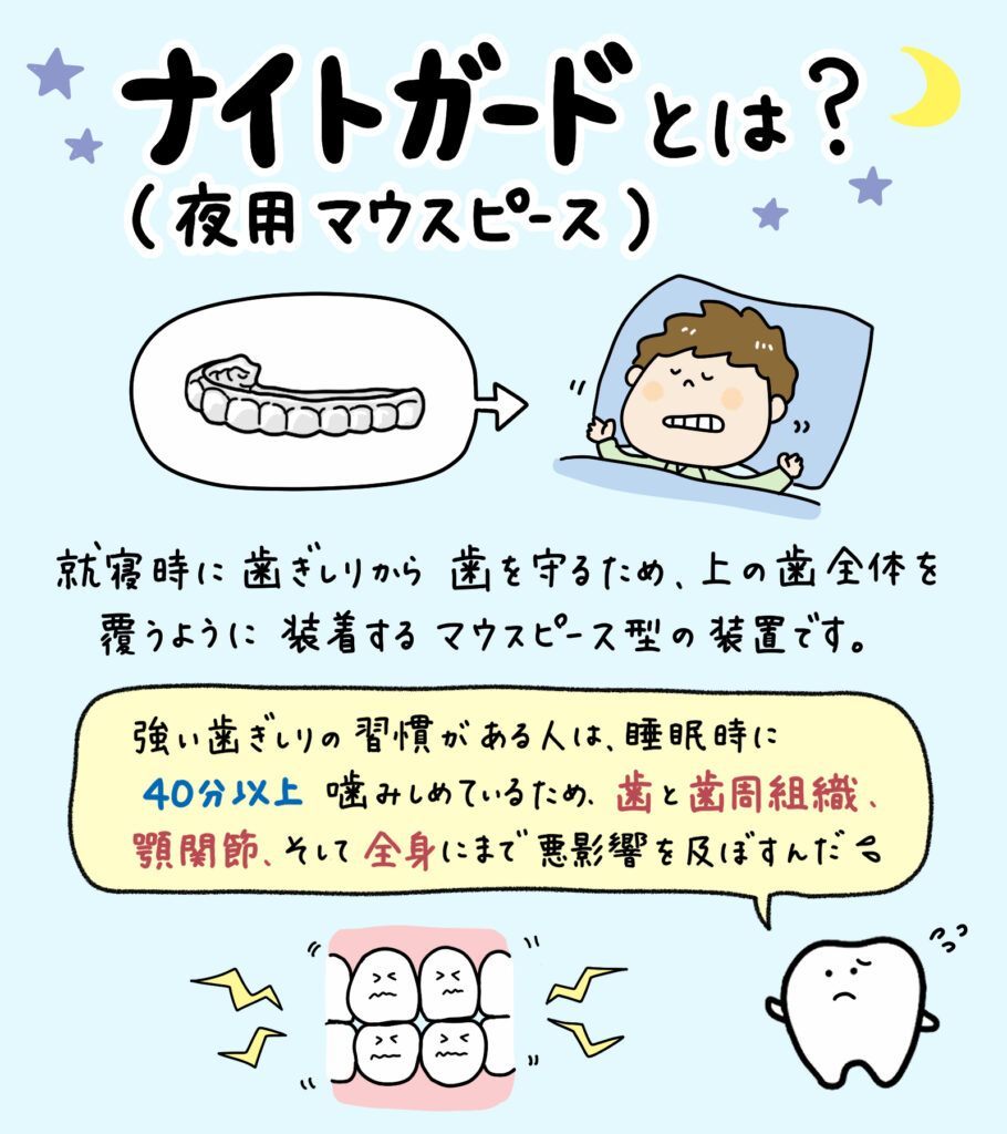 子どものナイトガード_1_子どもの夜用マウスピースの穴あき原因と対策を図解:歯ぎしりによる損傷メカニズム、正しい装着方法、定期的なチェックポイントをイラストで解説。