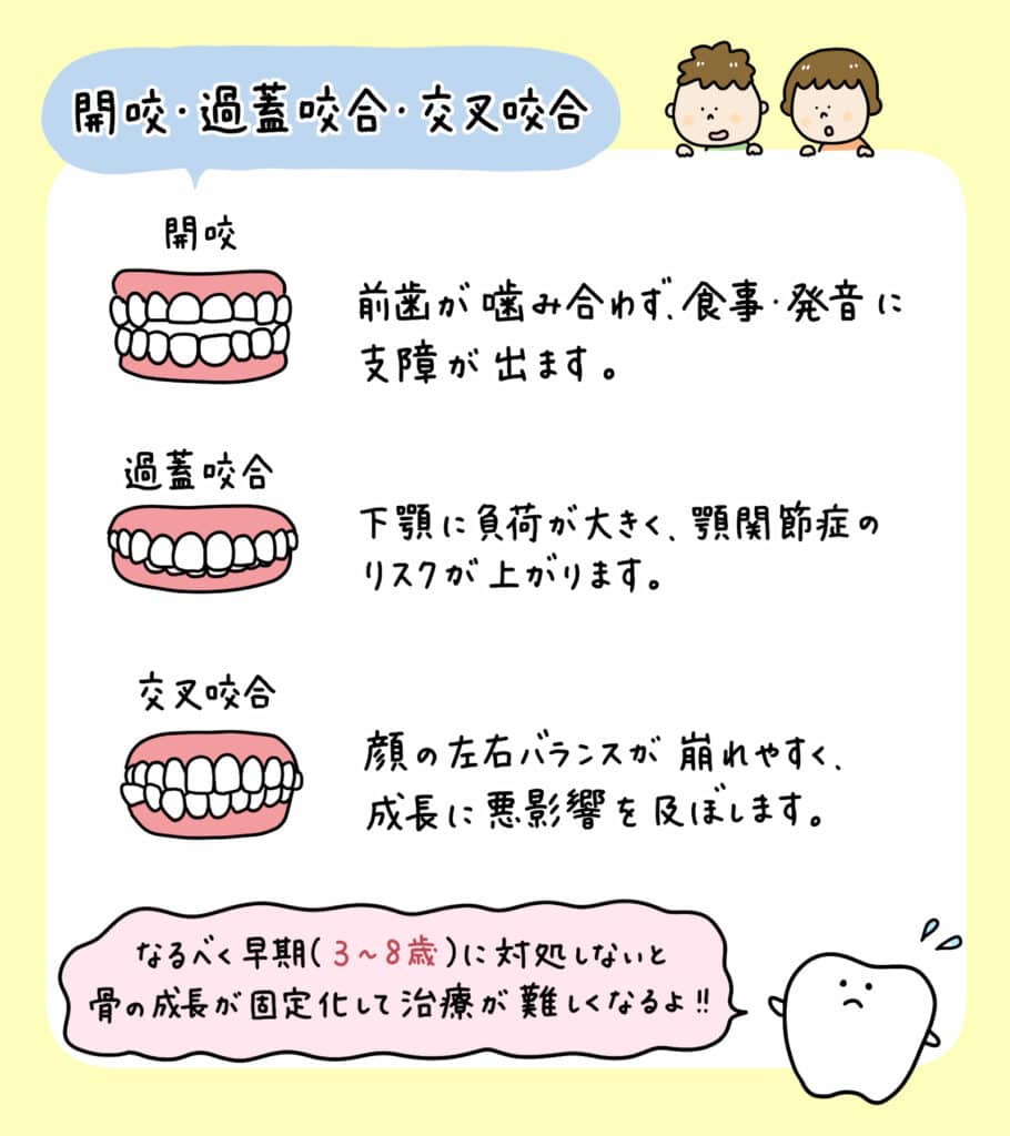 子供の歯列矯正いつから_10_子どもの矯正を始める最適な時期や治療方法を、年齢や症例、費用など多角的にイラストで解説