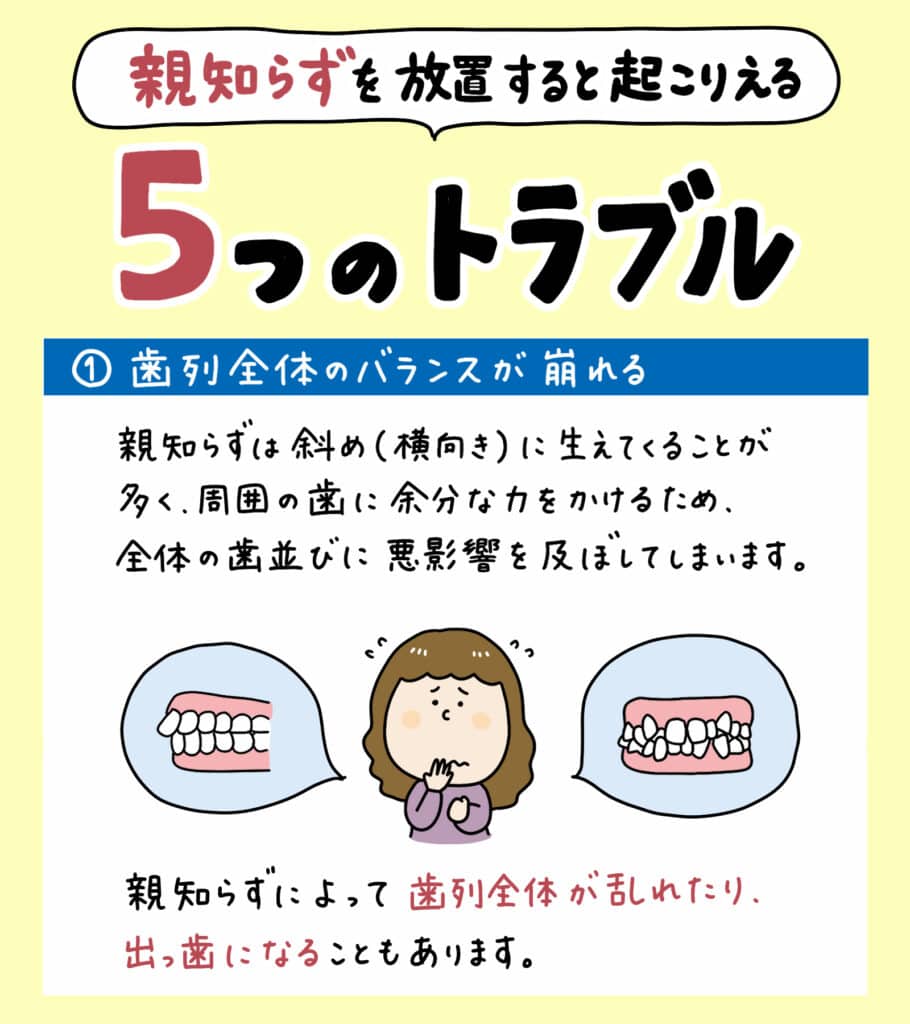 親知らずと歯並びの関係_7_親知らずが子どもの歯並びに影響するかどうか?についての解説イラスト