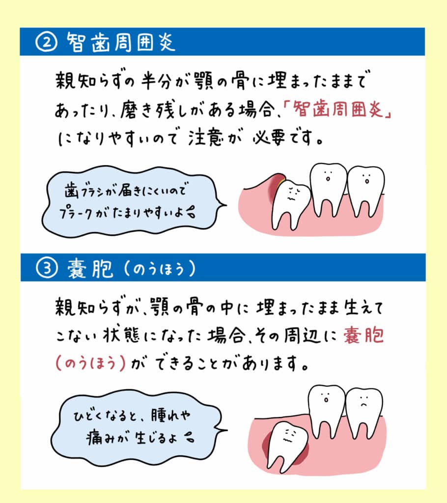 親知らずと歯並びの関係_8_親知らずが子どもの歯並びに影響するかどうか?についての解説イラスト