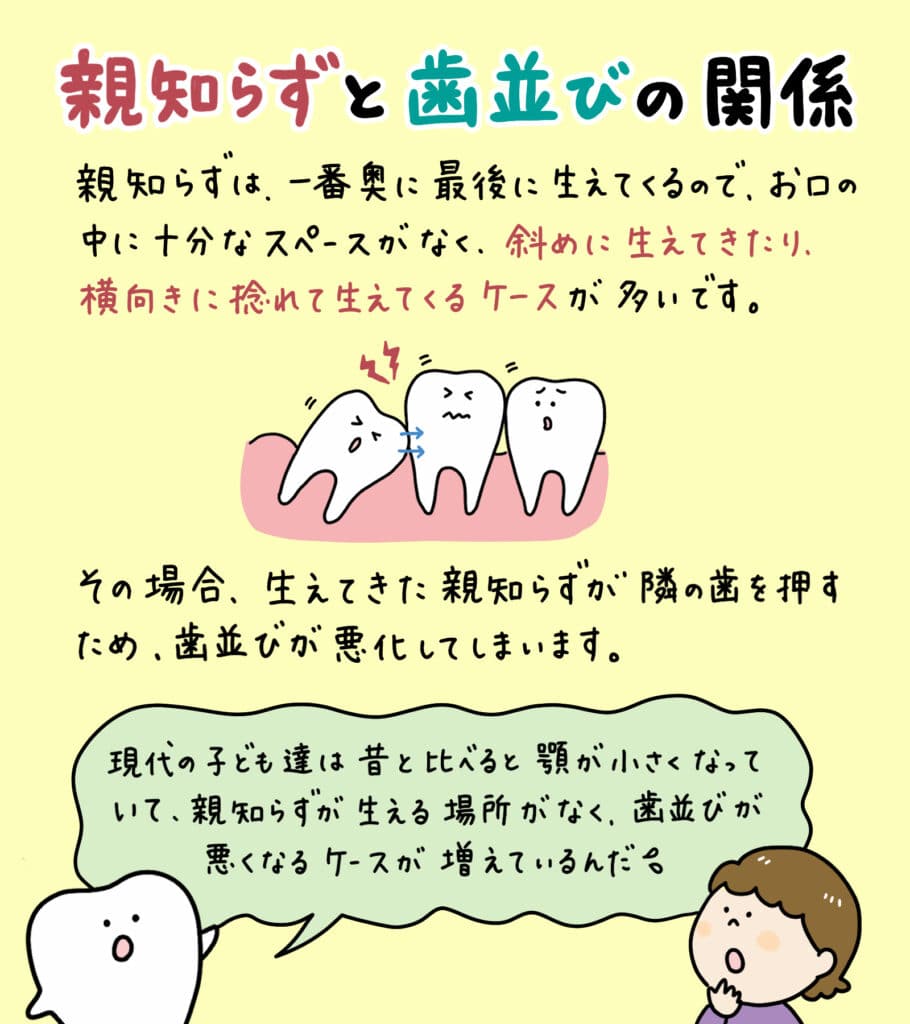 親知らずと歯並びの関係_5_親知らずが子どもの歯並びに影響するかどうか?についての解説イラスト