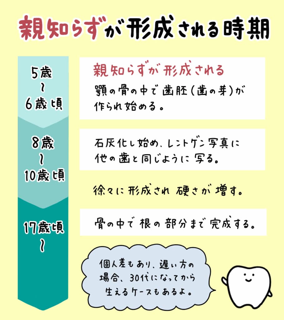親知らずと歯並びの関係_4_親知らずが子どもの歯並びに影響するかどうか?についての解説イラスト